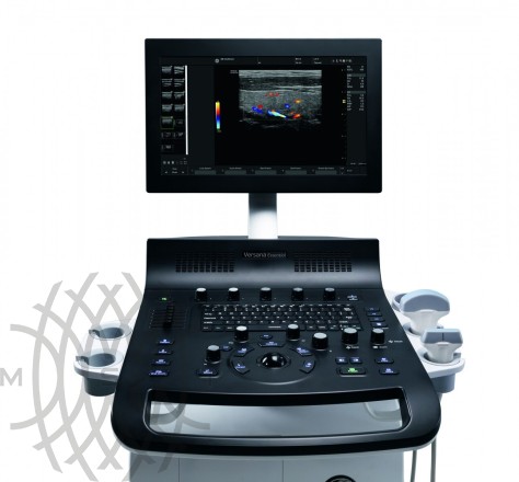 Ultratovush apparati GE Versana Essential