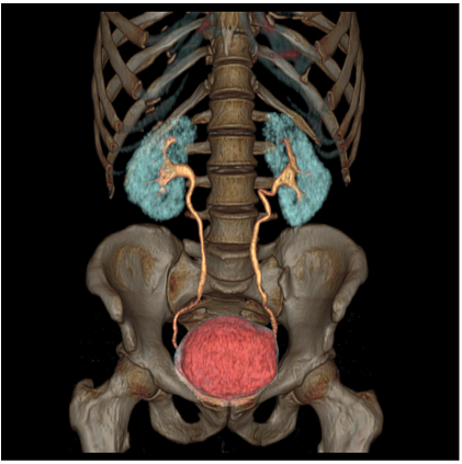 Компьютерный томограф GE Optima CT540 16 (32)