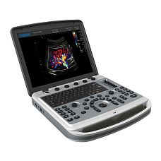 УЗИ аппарат Chison SonoBook 9