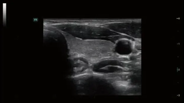 Mindray Consona N7 ультразвуковой аппарат