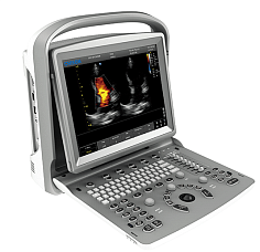 УЗИ аппарат Chison ECO 6