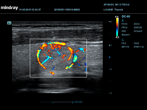 УЗИ аппарат Mindray DC-55