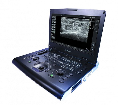 GE Versana Active Ultratovush apparati portativ