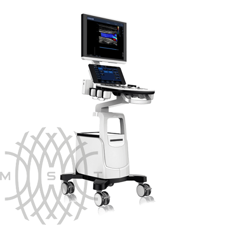 УЗИ аппарат Chison CBit 4