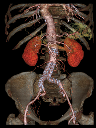 Компьютерный томограф GE Optima CT540 16 (32)