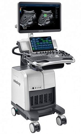 Mindray DC-80 Pro X-insight ultratovush apparati
