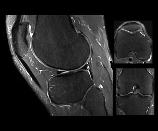 Магнитно-резонансный томограф GE SIGNA Architect 3T