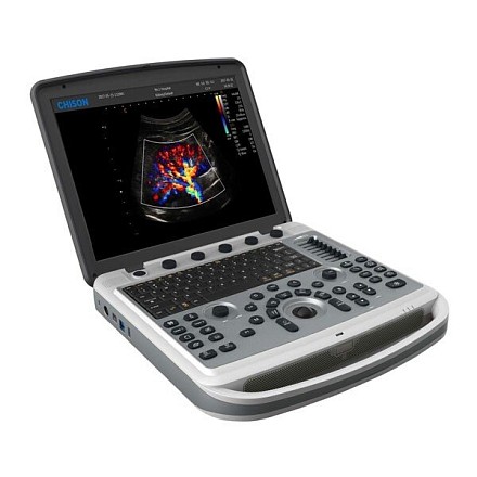Ultratovush apparati Chison SonoBook 9