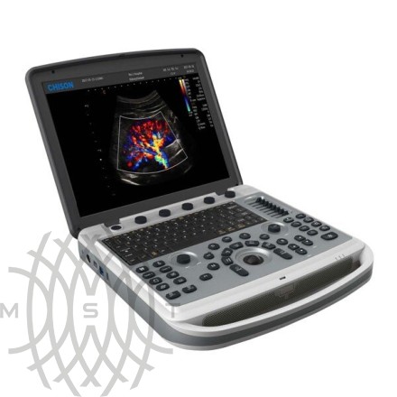 Ultratovush apparati Chison SonoBook 9