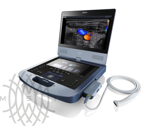 Edan Acclarix AX8 портативный УЗИ аппарат