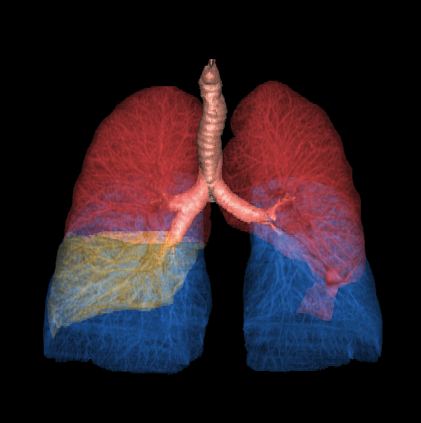 Компьютерный томограф GE Optima CT540 16 (32)