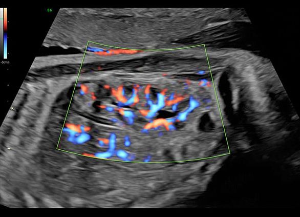 GE Voluson E6 аппарат УЗИ