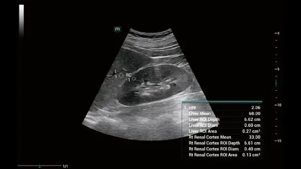 Mindray Consona N7 ультразвуковой аппарат