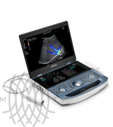 Portativ ultratovush apparati Mindray MX7