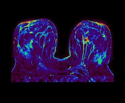 Магнитно-резонансный томограф GE SIGNA Architect 3T