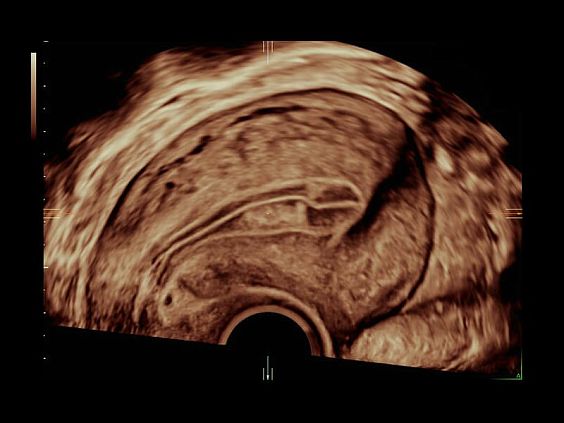 GE Voluson E10 аппарат УЗИ