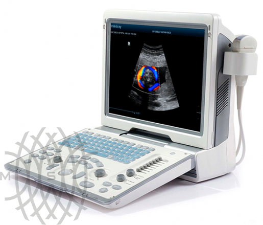 Mindray DP-50 Color ultratovush apparati