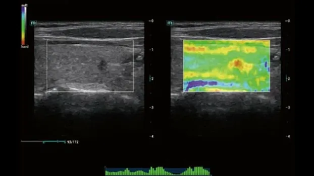 Mindray Consona N7 ультразвуковой аппарат