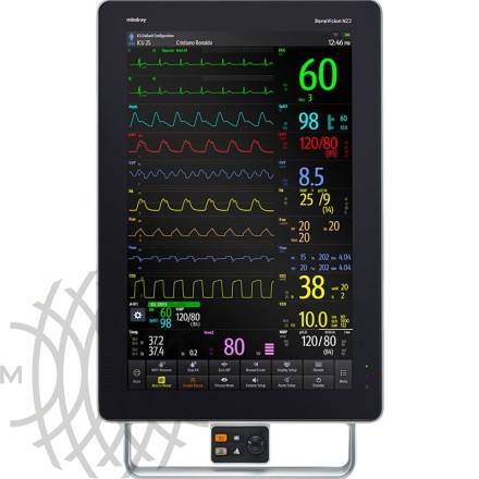 Mindray BeneVision N22 bemor monitori
